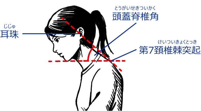 頭蓋脊椎角 耳珠 第7頚椎棘突起