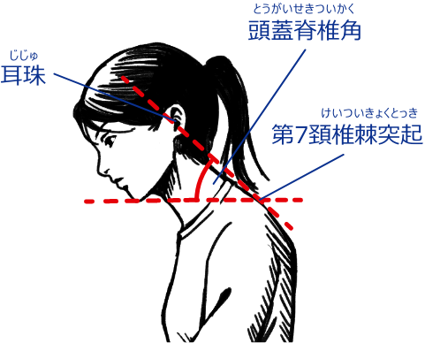 頭蓋脊椎角 耳珠 第7頚椎棘突起