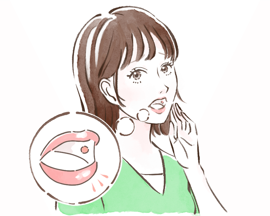 口内炎の症状・原因・対策のイメージ